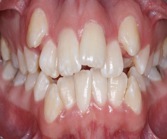 Dientes Juntos“>
	</div>
	<div class=